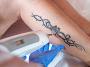 Tattoo Undo